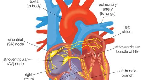 Conus Arteriosus Heart