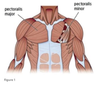 Pectoralis Major Strain - Sports Clinic NQ