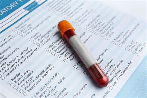 Top 10 Blood Tests for Older Adults: What to Know