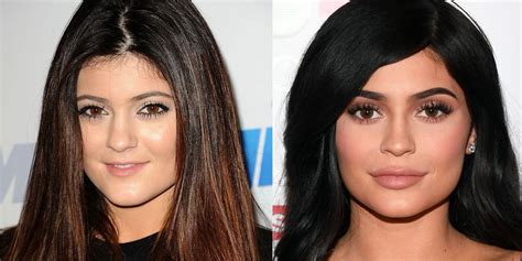 Plastic surgery before and after - 9 celebrities on what it's really like