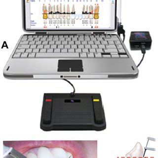 Florida Probe system. | Download Scientific Diagram