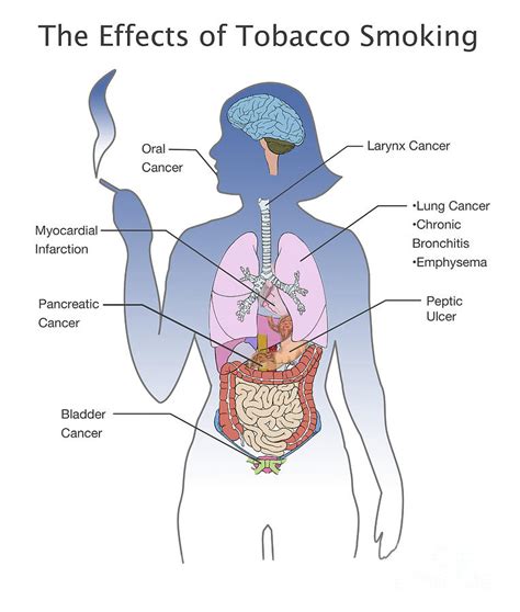 Effects Of Tobacco Smoking Photograph by Spencer Sutton