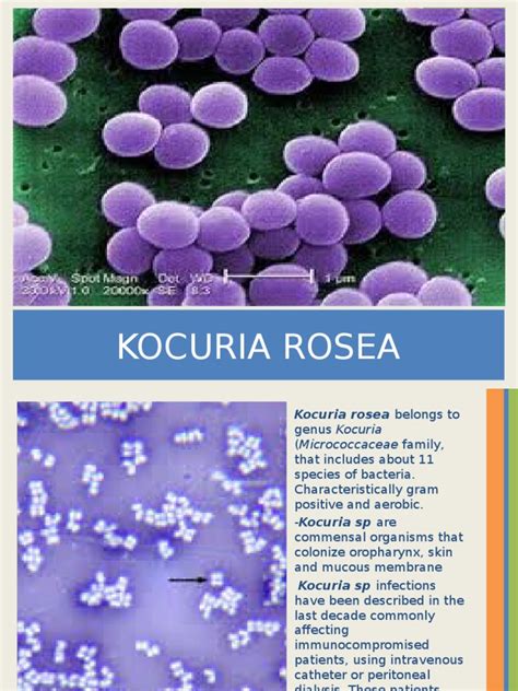 Kocuriarosea