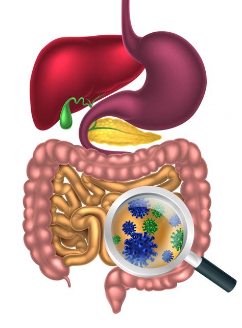 Gut Microbiota Seen to Differ in People with Relapsing MS