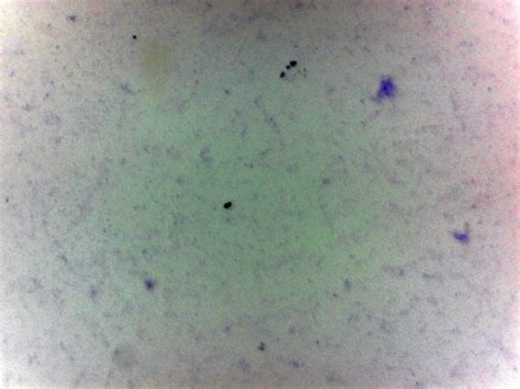 Bacteria (Three Types) Prepared Microscope Slide