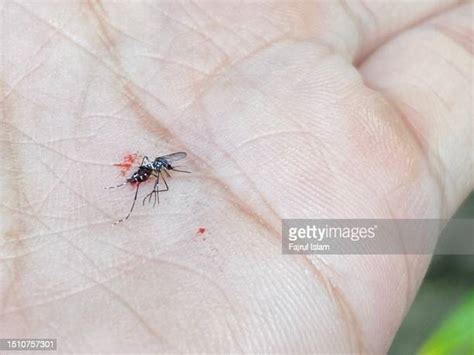 60 Asian Tiger Mosquito Bite Stock Photos, High-Res Pictures, and ...