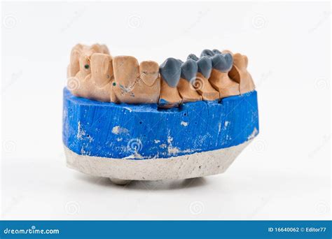 Dental wax model stock photo. Image of anatomy, background - 16640062