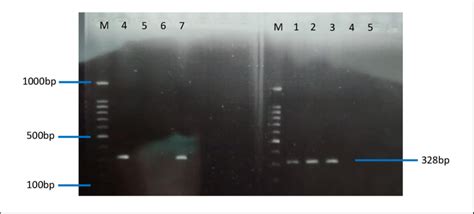 Agarose gel electrophoresis; M is 100 bp marker ladder DNA, Positive ...