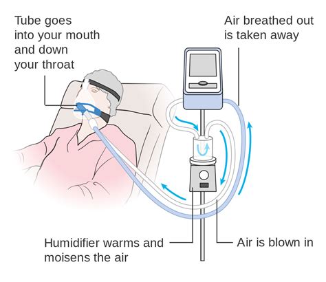 Here’s how a ventilator actually works - Hagerty Media