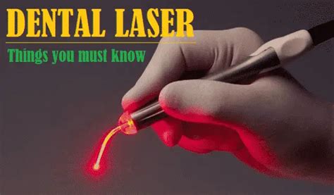 Dental Laser - Types, How it Works, Applications and Advantages