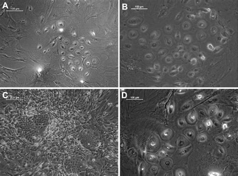 Morphology of keratinocytes differentiated from ADMSCs. (A ...