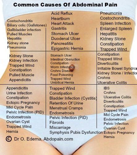 Common causes of abdominal pain : r/coolguides