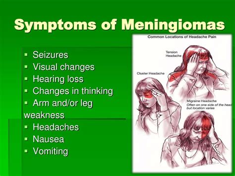 PPT - Meningiomas ( Benign, Atypical and Malignant or Anaplastic ...