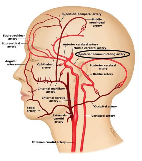 Posterior Communicating Artery - Stepwards