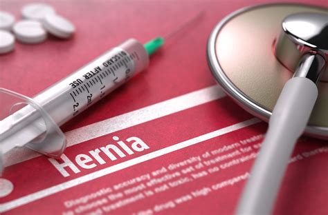 Hernia Mesh Complications, Failure and Recall Lawsuit Investigation