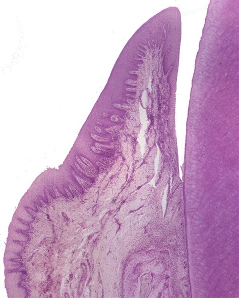 Gingiva and periodontium (40 X) - Anatomicum.com