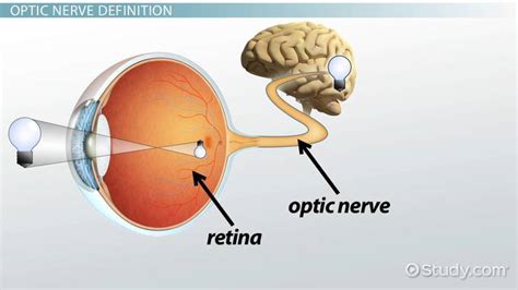 Optic Nerve Damage | Overview, Symptoms & Treatment - Video & Lesson ...