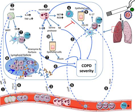 Copd Pathophysiology Concept Map Asthma Lung Disease | Images and ...