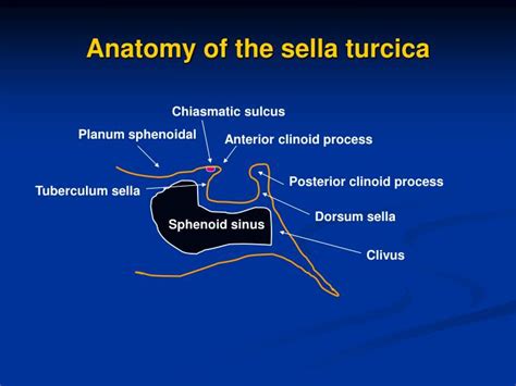 PPT - Sella turcica and parasellar region PowerPoint Presentation - ID ...