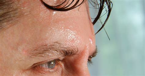 How to stop excessive sweating on your face - Melior Clinics