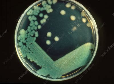 Pseudomonas aeruginosa bacteria - Stock Image - B220/0060 - Science ...