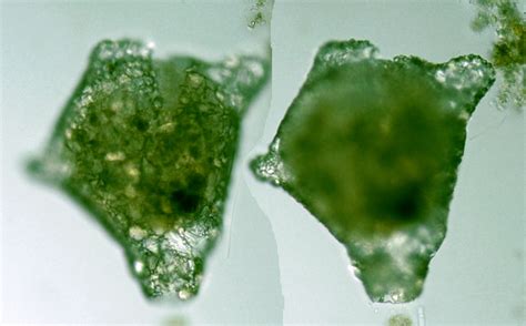 Protist Images: Difflugia crassa