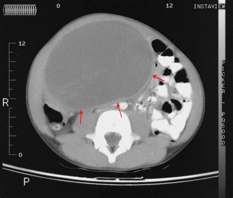 Gastrointestinal Radiology