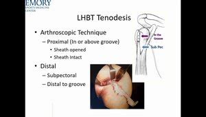 The Biceps Tendon: Tenodesis vs Tenotomy | VuMedi