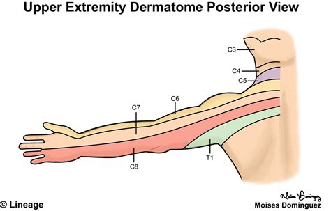 Dermatomes Upper Limb