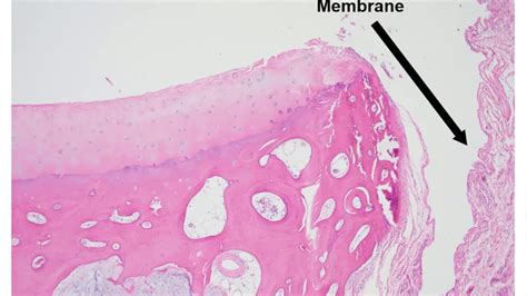 Synovial Membrane Histology