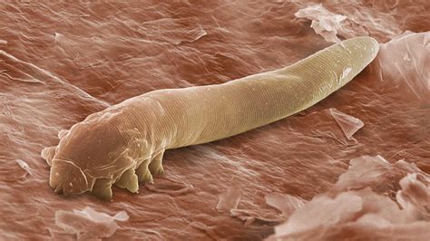 Tiny Creepy Crawlies Help Reveal Human History : Shots - Health News : NPR