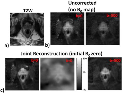 Figure 1 from Joint B0 and image estimation integrated with model based ...