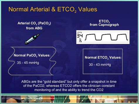 Copd Etco2 Waveform