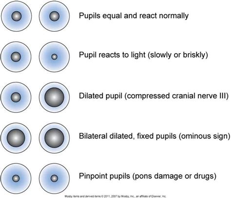 Pupil Size Chart Normal Range