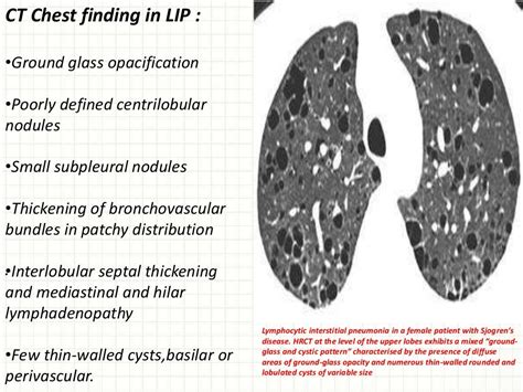 Cystic Lung Diseases