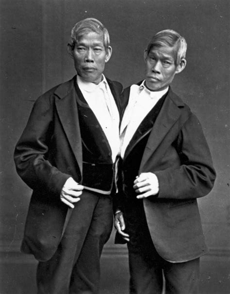 Surprising Facts About The First Ever Siamese Twins