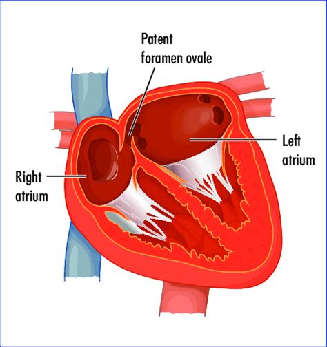 Anatomy of the patent foramen ovale. | Download Scientific Diagram