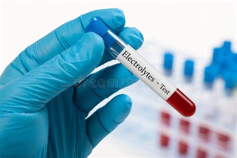 Electrolytes blood test stock image. Image of sample - 90300835