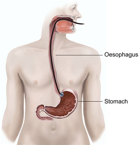 Endoscopic ultrasound | healthdirect