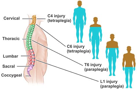 32. Head injury & Spinal cord Injury : 네이버 블로그