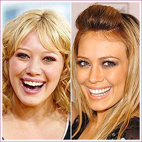 Celebrity Plastic Surgery Before & After (56 pics) - Izismile.com