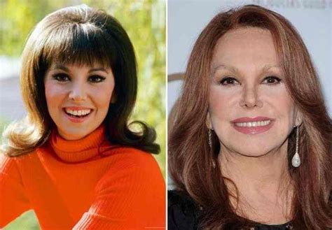 Marlo Thomas Plastic Surgery - Diversity News Magazine | Celebrity ...