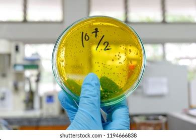 161 Lactobacillus rhamnosus Images, Stock Photos & Vectors | Shutterstock