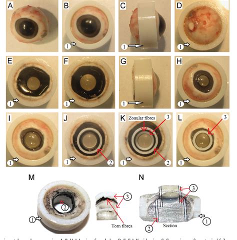 Structure of zonular fibers | Semantic Scholar