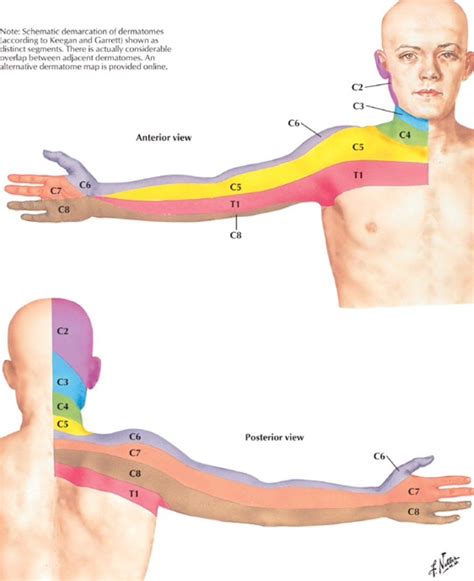 Dermatome distribution for the cervical spine - Netter | Medical ...