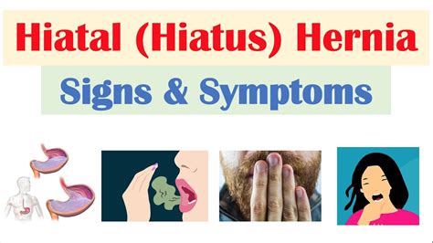 Hiatal (Hiatus) Hernia Signs & Symptoms (& Why They Occur) - YouTube