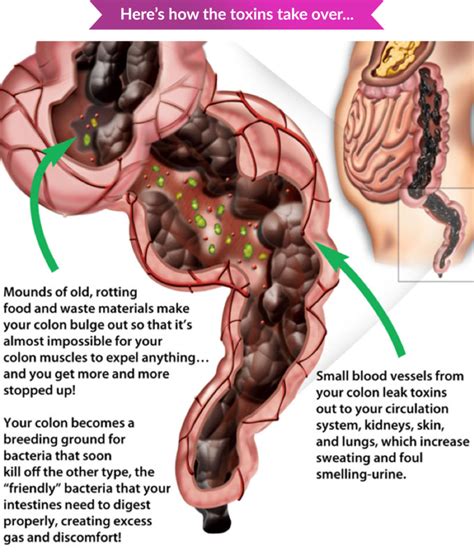 Constipation & Bowel Movement - Functional Health Network Functional ...