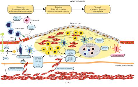 Figure 1 from Vascular Macrophages in Atherosclerosis | Semantic Scholar