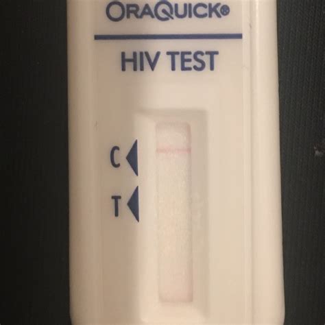 False Negative Elisa Hiv Falsepositive Hiv Test Go