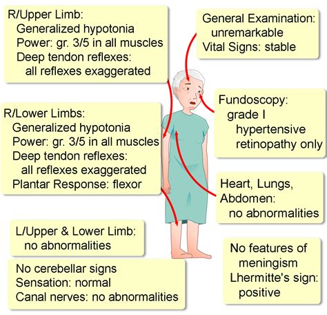 Cervical Epidural Hematoma - Interactive case study | Clinical Odyssey ...